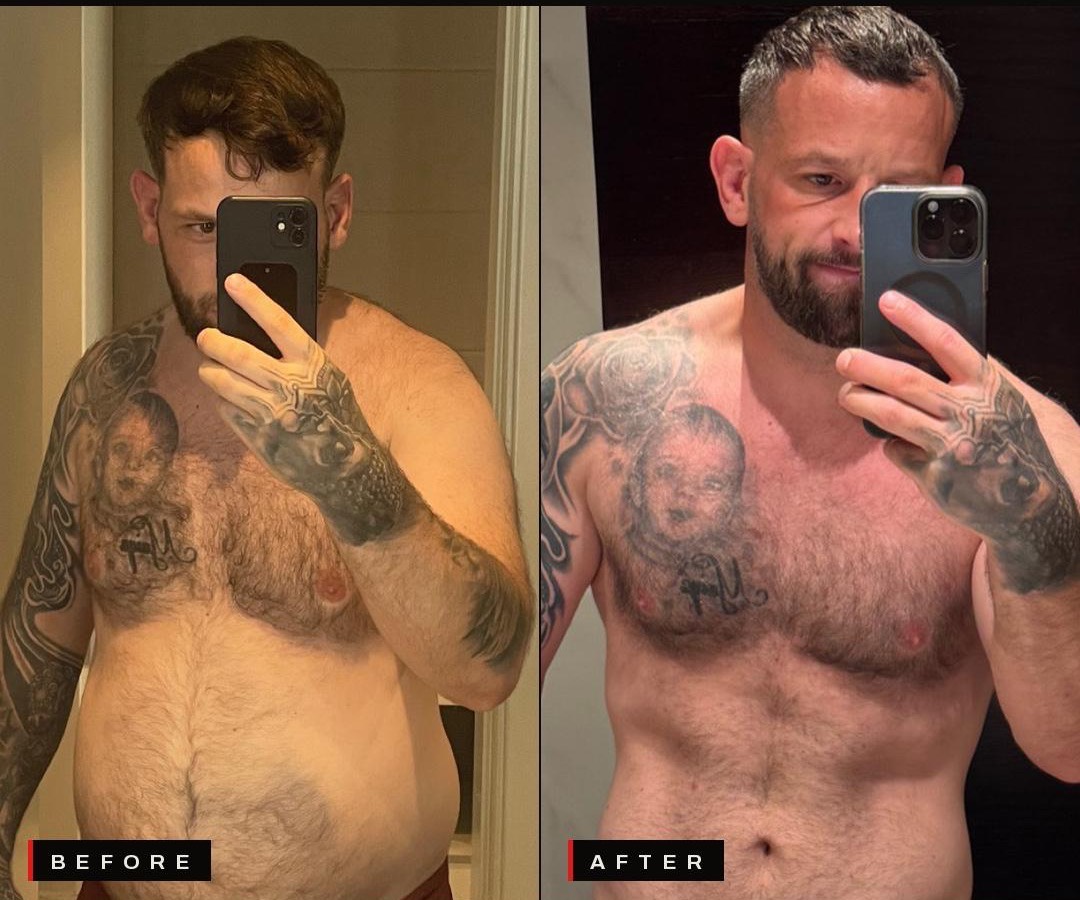 Ben K. before and after
