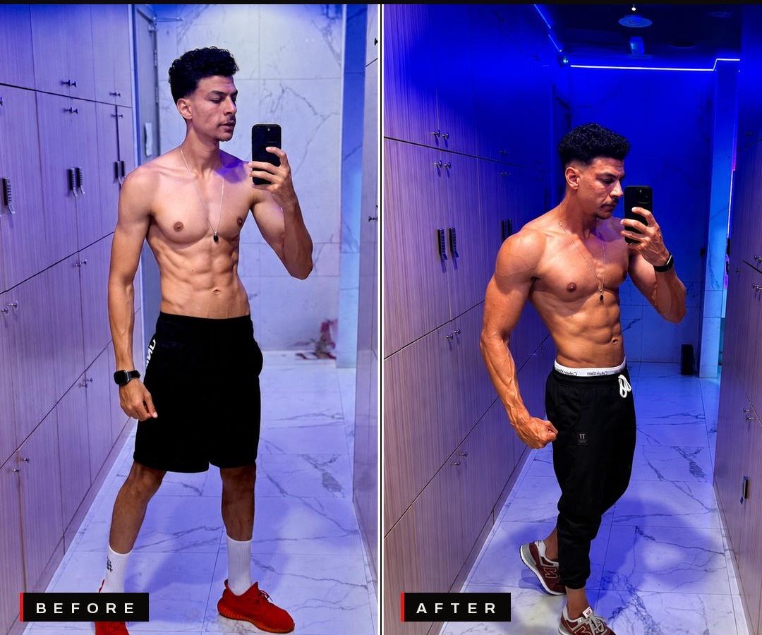 Mustafa R. before and after